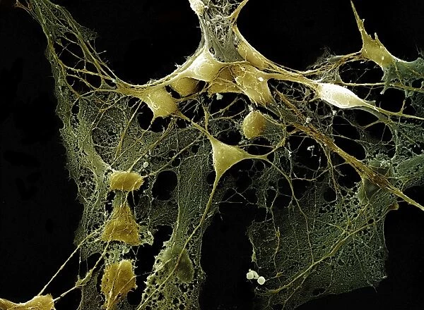 Scanning Electron Micrograph (SEM): Nerve cells grown in a culture 