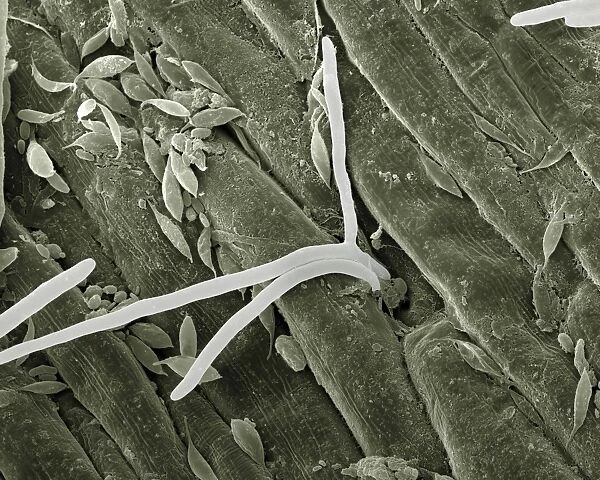 Scanning Electron Micrograph (SEM): Fusarium - Magnification x 2, 500 (A4 size: 29. 7 cm width)