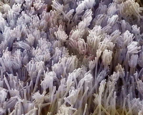 Scanning Electron Micrograph (SEM) showing fruiting bodies (conidiophores) of fungi Aspergillus sp. - Magnification x 7, 000 (A4 size: 29. 7 cm width)