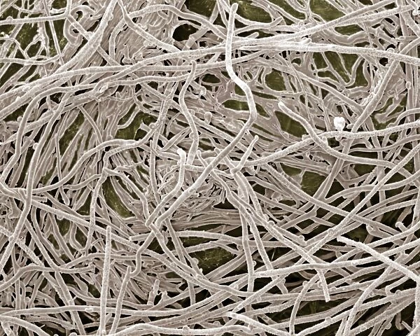 Scanning Electron Micrograph (SEM): Mycorrhiza; Magnification x 1, 500 (A4 size: 29. 7 cm width)