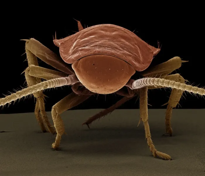 Framed Print : Scanning Electron Micrograph (SEM): American Cockroach; Magnification x 40 (A4 size: 29. 7 cm width) Framed Print : Scanning Electron Micrograph (SEM): American Cockroach; Magnification x 40 (A4 size: 29. 7 cm width)