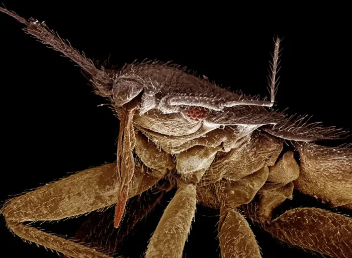 Framed Print : Scanning Electron Micrograph (SEM): Bedbug; Magnification x 120 (A4 size: 29. 7 cm width) Framed Print : Scanning Electron Micrograph (SEM): Bedbug; Magnification x 120 (A4 size: 29. 7 cm width)