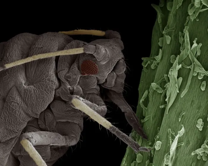 Framed Print : Scanning Electron Micrograph (SEM): Black Aphid - Magnification x 220 (if print A4 size: 29. 7 cm wide) Framed Print : Scanning Electron Micrograph (SEM): Black Aphid - Magnification x 220 (if print A4 size: 29. 7 cm wide)