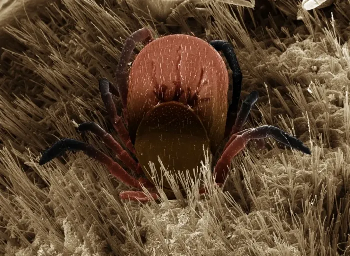 Framed Print : Scanning Electron Micrograph (SEM): Black-legged or Deer Tick, Magnification x 50 (A4 size: 29. 7 cm width) Framed Print : Scanning Electron Micrograph (SEM): Black-legged or Deer Tick, Magnification x 50 (A4 size: 29. 7 cm width)