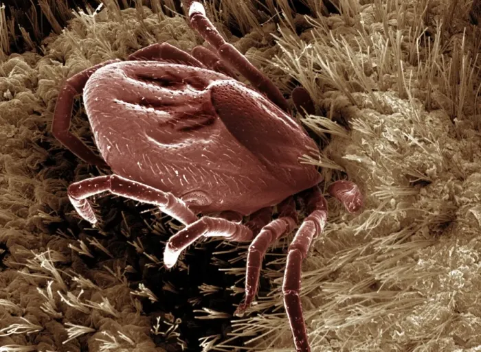 Framed Print : Scanning Electron Micrograph (SEM): Black-legged / Deer Tick - Magnification x 50 (if print A4 size: 29. 7 cm wide) Framed Print : Scanning Electron Micrograph (SEM): Black-legged / Deer Tick - Magnification x 50 (if print A4 size: 29. 7 cm wide)