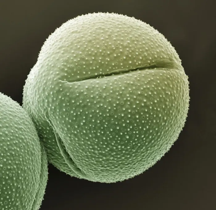 Framed Print : Scanning Electron Micrograph (SEM): Cactus pollen; Magnification x 3, 500 (A4 size: 29. 7 cm width) Framed Print : Scanning Electron Micrograph (SEM): Cactus pollen; Magnification x 3, 500 (A4 size: 29. 7 cm width)