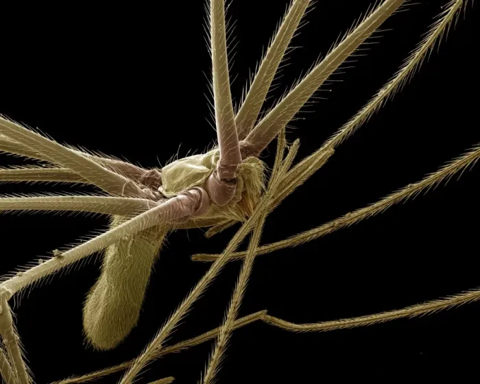 Framed Print : Scanning Electron Micrograph (SEM): Cellar or ‘Daddy-long-legs Spider, Magnification x 40 (A4 size: 29. 7 cm width) Framed Print : Scanning Electron Micrograph (SEM): Cellar or ‘Daddy-long-legs Spider, Magnification x 40 (A4 size: 29. 7 cm width)