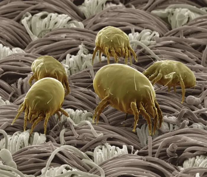 Framed Print : Scanning Electron Micrograph (SEM): Dust Mite ; Magnification x 300 (A4 size: 29. 7 cm width) Framed Print : Scanning Electron Micrograph (SEM): Dust Mite ; Magnification x 300 (A4 size: 29. 7 cm width)