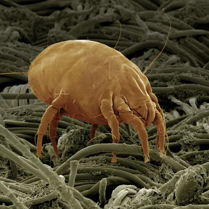 Framed Print : Scanning Electron Micrograph (SEM): Dust Mite; Magnification x 600 (A4 size: 29. 7 cm width) Framed Print : Scanning Electron Micrograph (SEM): Dust Mite; Magnification x 600 (A4 size: 29. 7 cm width)