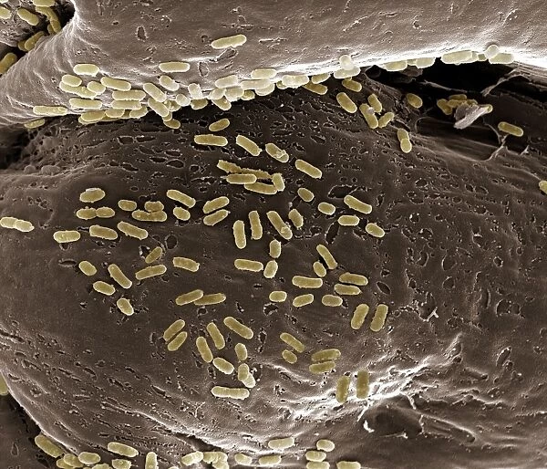Scanning Electron Micrograph (SEM): E. coli; Magnification x 15, 000 (A4 size: 29. 7 cm width)