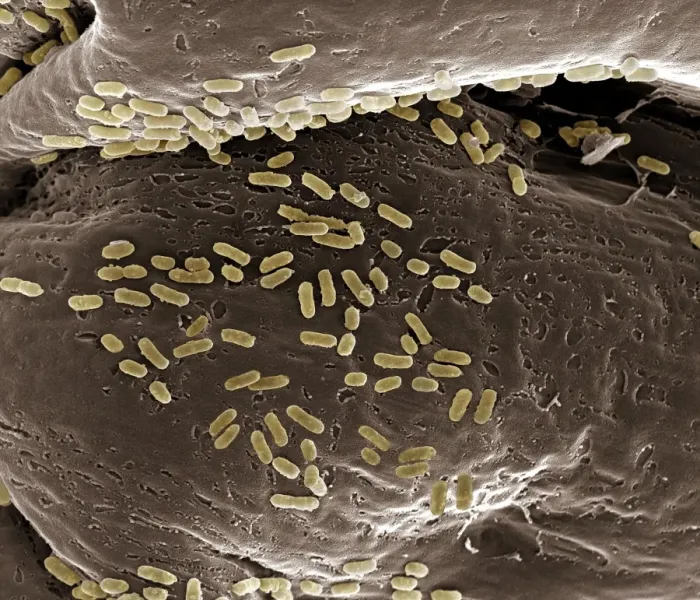 Framed Print : Scanning Electron Micrograph (SEM): E. coli; Magnification x 15, 000 (A4 size: 29. 7 cm width) Framed Print : Scanning Electron Micrograph (SEM): E. coli; Magnification x 15, 000 (A4 size: 29. 7 cm width)