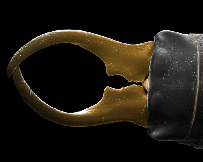 Framed Print : Scanning Electron Micrograph (SEM): Earwig; Magnification x 50 (A4 size: 29. 7 cm width) Framed Print : Scanning Electron Micrograph (SEM): Earwig; Magnification x 50 (A4 size: 29. 7 cm width)