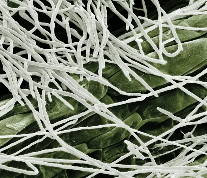 Framed Print : Scanning Electron Micrograph (SEM): Fusarium, Magnification x 1, 600 (A4 size: 29. 7 cm width) Framed Print : Scanning Electron Micrograph (SEM): Fusarium, Magnification x 1, 600 (A4 size: 29. 7 cm width)