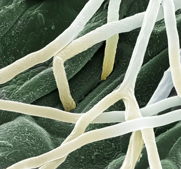 Framed Print : Scanning Electron Micrograph (SEM): Fusarium, Magnification x 7, 000 (A4 size: 29. 7 cm width) Framed Print : Scanning Electron Micrograph (SEM): Fusarium, Magnification x 7, 000 (A4 size: 29. 7 cm width)