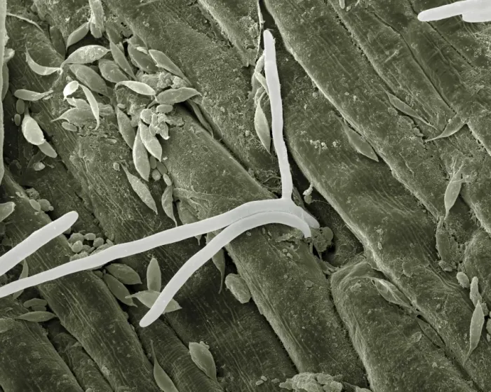 Framed Print : Scanning Electron Micrograph (SEM): Fusarium - Magnification x 2, 500 (A4 size: 29. 7 cm width) Framed Print : Scanning Electron Micrograph (SEM): Fusarium - Magnification x 2, 500 (A4 size: 29. 7 cm width)