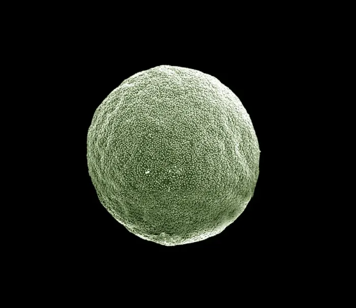 Framed Print : Scanning Electron micrograph (SEM): Grass Pollen grains; Magnification x 3000 (if printed 10. 5 cm wide) Framed Print : Scanning Electron micrograph (SEM): Grass Pollen grains; Magnification x 3000 (if printed 10. 5 cm wide)