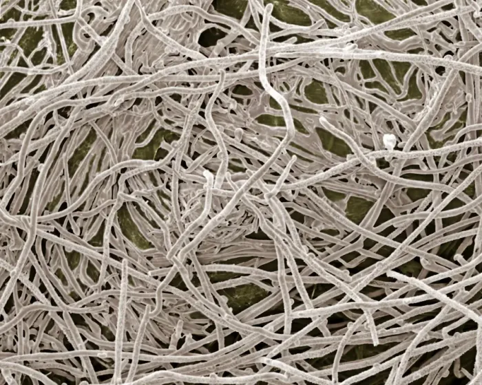 Framed Print : Scanning Electron Micrograph (SEM): Mycorrhiza; Magnification x 1, 500 (A4 size: 29. 7 cm width) Framed Print : Scanning Electron Micrograph (SEM): Mycorrhiza; Magnification x 1, 500 (A4 size: 29. 7 cm width)