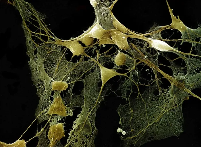Framed Print : Scanning Electron Micrograph (SEM): Nerve cells grown in a culture Framed Print : Scanning Electron Micrograph (SEM): Nerve cells grown in a culture
