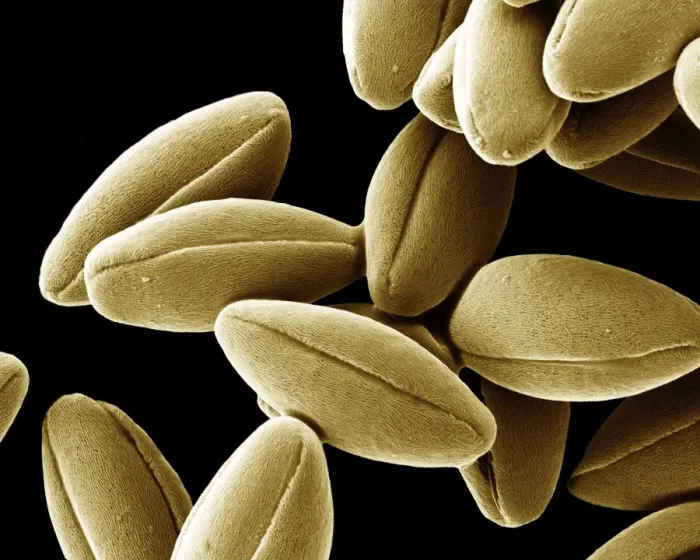 Framed Print : Scanning Electron Micrograph (SEM); Pollen of Speedwell, Magnification x 2, 500 (A4 size: 29. 7 cm width) Framed Print : Scanning Electron Micrograph (SEM); Pollen of Speedwell, Magnification x 2, 500 (A4 size: 29. 7 cm width)