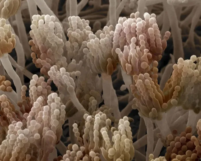 Framed Print : Scanning Electron Micrograph (SEM) showing fruiting bodies (conidiophores) of fungi Aspergillus sp. ; Magnification x 7, 000 (A4 size: 29. 7 cm width) Framed Print : Scanning Electron Micrograph (SEM) showing fruiting bodies (conidiophores) of fungi Aspergillus sp. ; Magnification x 7, 000 (A4 size: 29. 7 cm width)