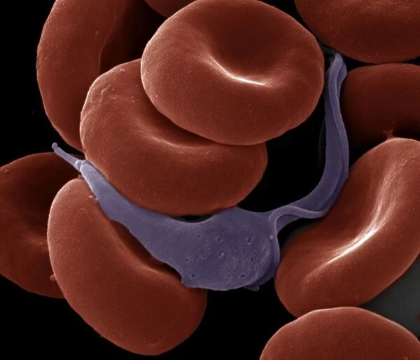 Sleeping Sickness Parasite in red blood cells