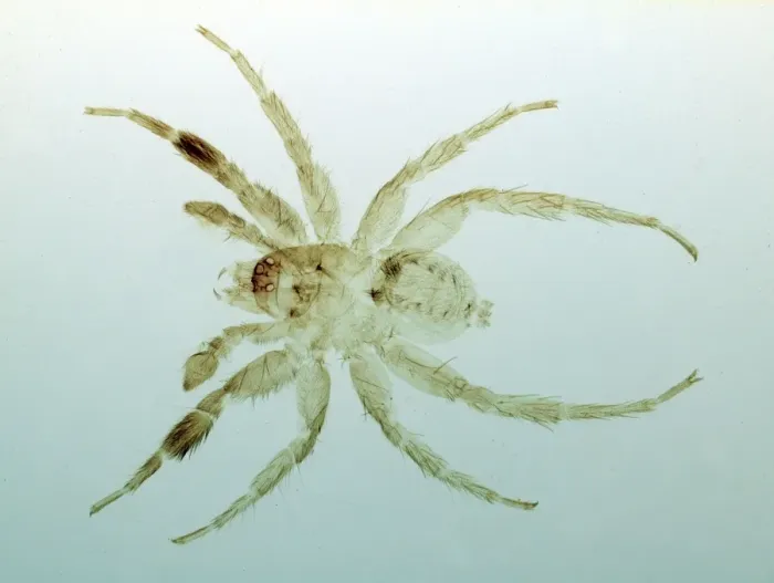 Framed Print : Spider. Microscope preparation of eyes and fangs Framed Print : Spider. Microscope preparation of eyes and fangs
