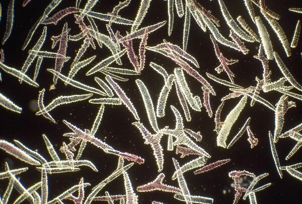 Sponge Spicules - microscopic, x4 magnification