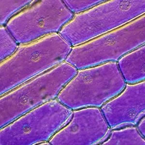 Light Micrograph (LM): Onion skin cells; Magnification x600 (on 10. 5 cm width print)