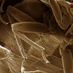 Scanning Electron Micrograph (SEM) Bedbugs mating; Magnification x 250 (A4 size: 29. 7 cm width)