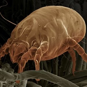 Scanning Electron Micrograph (SEM) Dust Mite; Magnification x 700 (A4 size: 29. 7 cm width)