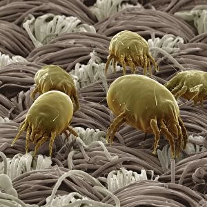Scanning Electron Micrograph (SEM): Dust Mite ; Magnification x 300 (A4 size: 29. 7 cm width)