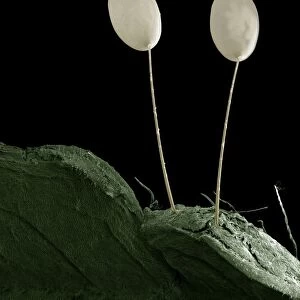 Scanning Electron Micrograph (SEM): Egs of Green Lacewing; Magnification x 85 (A4 size: 29. 7 cm width)