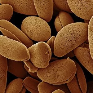 Scanning Electron Micrograph (SEM): Lily pollen; Magnification x 850 (A4 size: 29. 7 cm width)