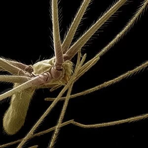 Scanning Electron Micrograph (SEM): Cellar or ‘Daddy-long-legs Spider, Magnification x 40 (A4 size: 29. 7 cm width)