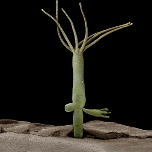 Scanning Electron Micrograph (SEM): Hydra - Magnification unknown