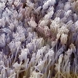 Scanning Electron Micrograph (SEM) showing fruiting bodies (conidiophores) of fungi Aspergillus sp. - Magnification x 7, 000 (A4 size: 29. 7 cm width)