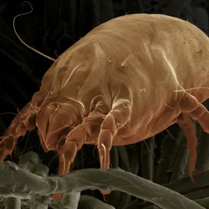 Scanning Electron Micrograph (SEM) Dust Mite; Magnification x 700 (A4 size: 29. 7 cm width) Scanning Electron Micrograph (SEM) Dust Mite; Magnification x 700 (A4 size: 29. 7 cm width)