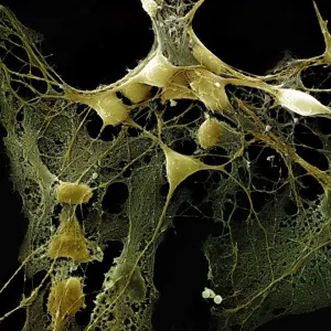 Scanning Electron Micrograph (SEM): Nerve cells grown in a culture Scanning Electron Micrograph (SEM): Nerve cells grown in a culture