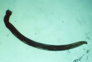 American Hookworm - x 5
