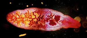 Microscopic Gallery: Dark Field Light Micrograph: Lancet Liver Fluke