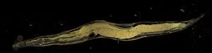 Worm Gallery: Dark Field Light Micrograph (LM): Human Pinworm