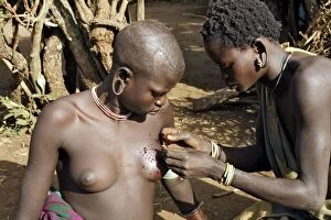 Images Dated 1st August 2006: Ethiopia - scarifications ritual among Surma