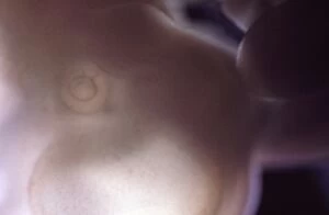 Foetal Gallery: Eye detail of a rat embryo at 13.2 days after fertilisation