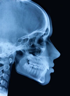 Body Gallery: Girl Head x-ray and silhouette double exposure