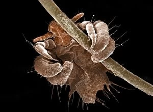 Pest Gallery: Human Crab Louse