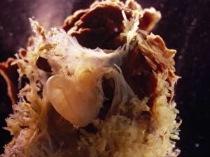 Foetal Gallery: Human Embryo With Placenta