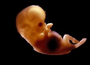 Human Foetus 10-11 weeks after fertilisation