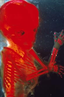 Foetal Gallery: Human Foetus 12 weeks - red dye to show bones