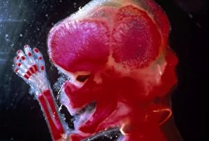 Foetal Gallery: Human Foetus - red dye to show bones