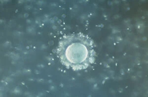 Fertilizing Gallery: A human Ovum surrounded by Sperm - being fertilized